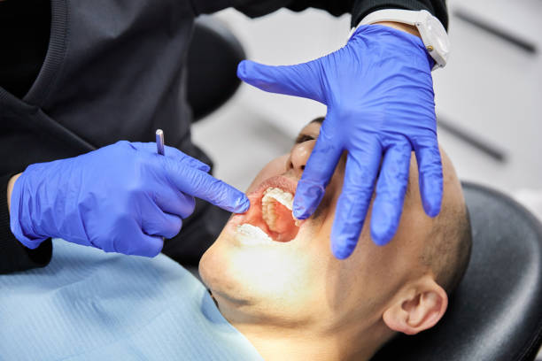 Best Emergency Root Canal Treatment in Algona, WA