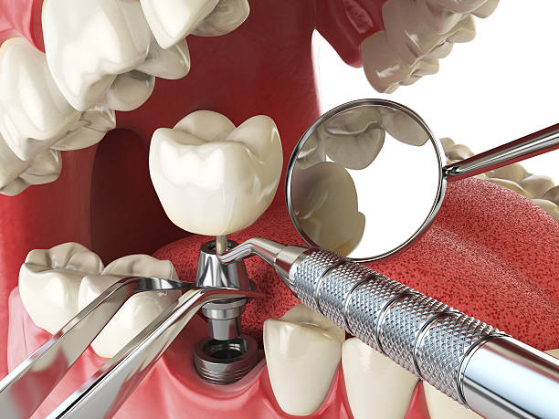 Best Emergency Dental Care for Trauma or Injury in Algona, WA